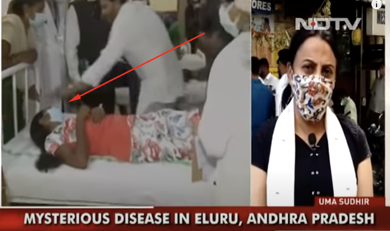 Hindistan’daki Gizemli Hastalık & Yeni Virüs: Binlerce Kişi Hastanede